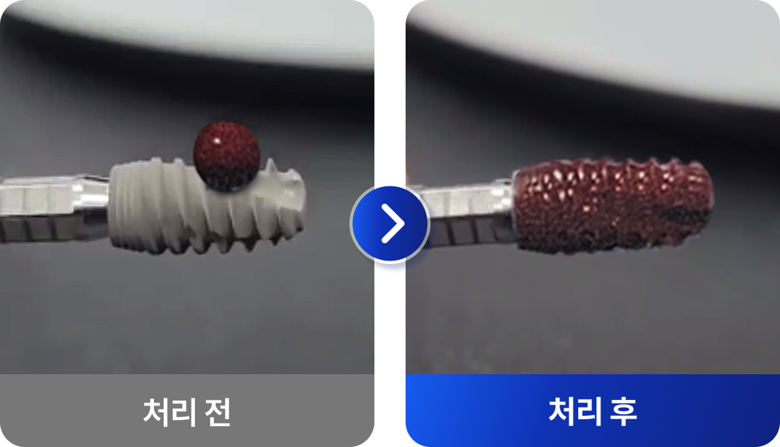 플란 플라즈마 처리 전/처리 후
