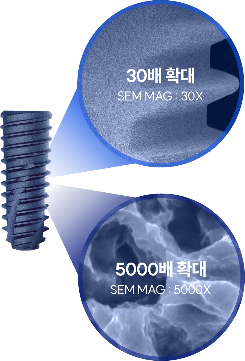 플란 임플란트의 골유착 기술력
